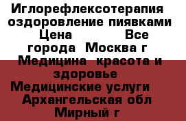 Иглорефлексотерапия, оздоровление пиявками › Цена ­ 3 000 - Все города, Москва г. Медицина, красота и здоровье » Медицинские услуги   . Архангельская обл.,Мирный г.